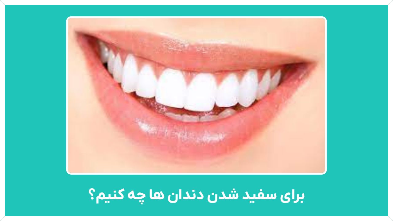 برای سفید شدن دندان ها چه کنیم؟